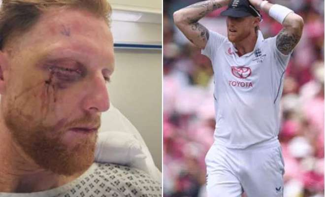 چہرے پر سنگین چوٹ لگنے کے باوجود زندہ بچ جانا میری خوش قسمتی ہے، بین سٹوکس